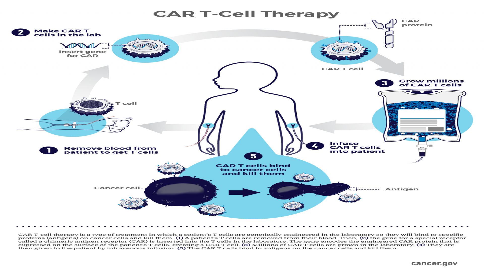 Immune System Reprogramming: Successes and Limitations of CAR-T Cell Therapy